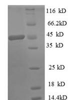 Human Diamine acetyltransferase 1 (SAT1) Recombinant Protein, N-GST - BioCrest Sci