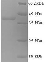 Human Myelin expression factor 2 (MYEF2), partial Recombinant Protein - BioCrest Sci