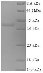 Human Myelin expression factor 2 (MYEF2), partial Recombinant Protein, Homo sapiens (Human), E.coli, N-terminal 6xHis-SUMO-tagged, 37.3 kDa, purity >≥ 90% as determined by SDS-PAGE.