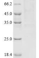 Human Receptor-type tyrosine-protein phosphatase T (PTPRT), partial Recombinant Protein - BioCrest Sci