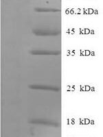 Human Protein-arginine deiminase type-2 (PADI2) Recombinant Protein, N-His-SUMO - BioCrest Sci