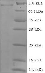 Human Protein-arginine deiminase type-2 (PADI2) Recombinant Protein, N-His-SUMO, Homo sapiens (Human), E.coli, N-terminal 6xHis-SUMO-tagged, 91.6 kDa, purity >≥ 90% as determined by SDS-PAGE.