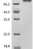 Mouse Fibroblast growth factor 1 (Fgf1) Recombinant Protein, N-HSA/C-10His - BioCrest Sci