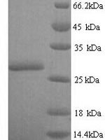 Escherichia coli Oxygen-insensitive NADPH nitroreductase (nfsA) Recombinant Protein - BioCrest Sci