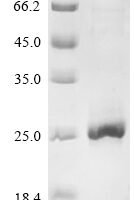 Rat Troponin I, fast skeletal muscle (Tnni2) Recombinant Protein - BioCrest Sci