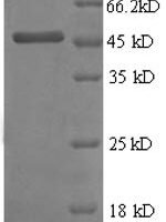 Human Metalloproteinase inhibitor 2 (TIMP2), partial Recombinant Protein - BioCrest Sci