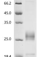 Human Fibroblast growth factor 7 (FGF7) Recombinant Protein - BioCrest Sci