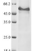 Human Thyroglobulin (TG), partial Recombinant Protein - BioCrest Sci