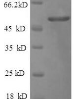 Human Cerebellar degeneration-related protein 2 (CDR2) Recombinant Protein - BioCrest Sci