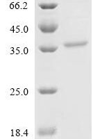 Mouse Endothelin-1 (Edn1), partial Recombinant Protein, C-hFc1-Myc - BioCrest Sci