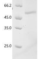 Tick-borne encephalitis virus European subtype Genome polyprotein, partial Recombinant Protein, C-10His - BioCrest Sci