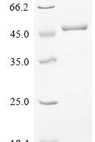 Human Myosin regulatory light chain 12B (MYL12B) Recombinant Protein, N-His-GST - BioCrest Sci
