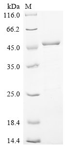 Human Myosin regulatory light chain 12B (MYL12B) Recombinant Protein, N-His-GST, Homo sapiens (Human), E.coli, N-terminal 6xHis-GST-tagged, 51.3 kDa, purity >≥ 85% as determined by SDS-PAGE.