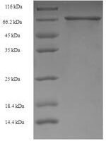 Human Ig gamma-1 chain C region (IGHG1) Recombinant Protein - BioCrest Sci