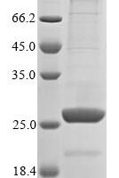 Mouse Angiopoietin-like protein 8 (Angptl8) Recombinant Protein, N-10His - BioCrest Sci