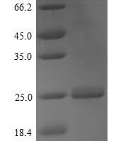 Mouse Apolipoprotein M (Apom) Recombinant Protein, N-His - BioCrest Sci