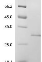 Mouse Aquaporin-7 (Aqp7), partial Recombinant Protein - BioCrest Sci