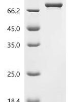 Mouse Inhibin beta C chain (Inhbc) Recombinant Protein - BioCrest Sci