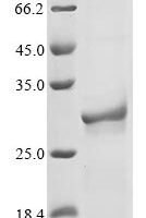 Mouse Nicotinamide riboside kinase 1 (Nrk1) Recombinant Protein - BioCrest Sci