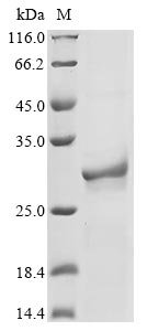 Mouse Nicotinamide riboside kinase 1 (Nrk1) Recombinant Protein, Mus musculus (Mouse), E.coli, N-terminal 6xHis-tagged, 26.4 kDa, purity >≥ 85% as determined by SDS-PAGE.
