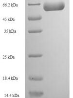Human Actin-like protein 7A (ACTL7A) Recombinant Protein - BioCrest Sci