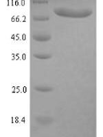 Human Clathrin interactor 1 (CLINT1) Recombinant Protein, N-His, aa 1–625, E.coli - BioCrest Sci