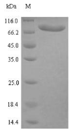 Human Clathrin interactor 1 (CLINT1) Recombinant Protein, N-His, aa 1–625, E.coli, Homo sapiens (Human), E.coli, N-terminal 6xHis-tagged, 72.3 kDa, purity >≥ 90% as determined by SDS-PAGE.