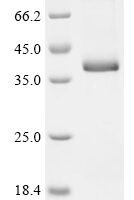 Mouse Growth/differentiation factor 15 (Gdf15) Recombinant Protein, N-hFC - BioCrest Sci