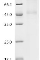 Human Eukaryotic initiation factor 4A-I (EIF4A1) Recombinant Protein, C-10His - BioCrest Sci