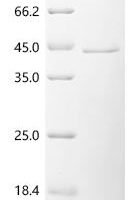 Human Tumor necrosis factor receptor type 1-associated DEATH domain protein (TRADD) Recombinant Protein, C-His - BioCrest Sci