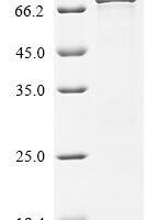Human Methyltransferase-like protein 25 (METTL25) Recombinant Protein - BioCrest Sci
