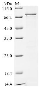 Human Methyltransferase-like protein 25 (METTL25) Recombinant Protein, Homo sapiens (Human), E.coli, N-terminal 10xHis-tagged and C-terminal Myc-tagged, 75.7 kDa, purity >≥ 85% as determined by SDS-PAGE.