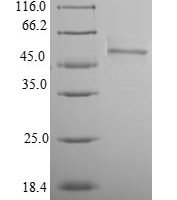 Mouse Homeobox protein Nkx-3.2 (Nkx3-2) Recombinant Protein, N-10His-SUMO, aa 1–333, Purity ≥90% - BioCrest Sci