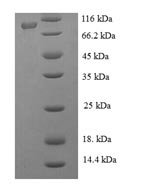 Japanese encephalitis virus Genome polyprotein, partial Recombinant Protein - BioCrest Sci