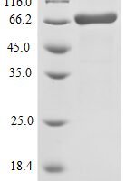 Vaccinia virus Protein OPG068 (OPG068), partial Recombinant Protein - BioCrest Sci