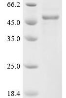 Human Sodium channel protein type 1 subunit alpha (SCN1A)，partial Recombinant Protein - BioCrest Sci