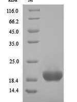 Clostridium botulinum  Hemagglutinin component of the neurotoxin complex (ha17) Recombinant Protein - BioCrest Sci