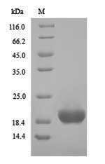 Clostridium botulinum Hemagglutinin component of the neurotoxin complex (ha17) Recombinant Protein, Clostridium botulinum (strain Hall / ATCC 3502 / NCTC 13319 / Type A), Yeast, N-terminal 6xHis-tagged, 18.9 kDa, purity >≥ 90% as determined by SDS-PAGE.