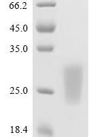 Mouse Bridging integrator 1 (Bin1), partial Recombinant Protein, N-His - BioCrest Sci