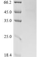 Human CD70 antigen (CD70), partial Recombinant Protein, N-hFc1 - BioCrest Sci