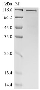 Human CD70 antigen (CD70), partial Recombinant Protein, N-hFc1, Homo sapiens (Human), Mammalian cell, N-terminal hFc1-tagged, 67.8 kDa, purity >≥ 90% as determined by SDS-PAGE.