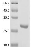 Escherichia coli Shikimate kinase 2 (aroL) Recombinant Protein - BioCrest Sci