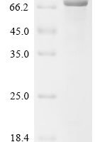 Human Glucose 1,6-bisphosphate synthase(PGM2L1) Recombinant Protein - BioCrest Sci