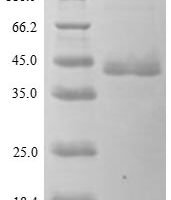 Human Paraneoplastic antigen Ma2 (PNMA2), partial Recombinant Protein, N-His, aa 2–261, Yeast - BioCrest Sci