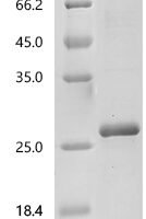 Human Regenerating islet-derived protein 3-alpha (REG3A) Recombinant Protein, C-His - BioCrest Sci
