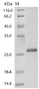 Human Regenerating islet-derived protein 3-alpha (REG3A) Recombinant Protein, C-His, E.coli, C-terminal 6xHis-tagged, 23.5 kDa, purity >≥ 85% as determined by SDS-PAGE.