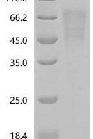 Human Seizure protein 6 homolog (SEZ6), partial Recombinant Protein, C-10His, aa 20–354 - BioCrest Sci