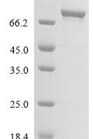 Human HLA class II histocompatibility antigen gamma chain (CD74), partial Recombinant Protein - BioCrest Sci