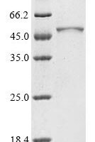 Human Plasma alpha-L-fucosidase (FUCA2) Recombinant Protein - BioCrest Sci