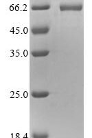 Mouse Vimentin (Vim) Recombinant Protein - BioCrest Sci